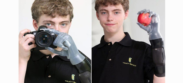 Mercedes schenkt Jungen eine künstliche Hand  : Der 14jährige Junge hatte in einem bewegenden Brief  Mercedes GP Petronas F1 Teamchef Ross Brawn um Hilfe gebeten 